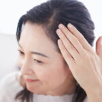 分け目のあたりの髪が、以前より目立つ