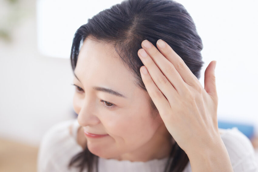 分け目のあたりの髪が、以前より目立つ